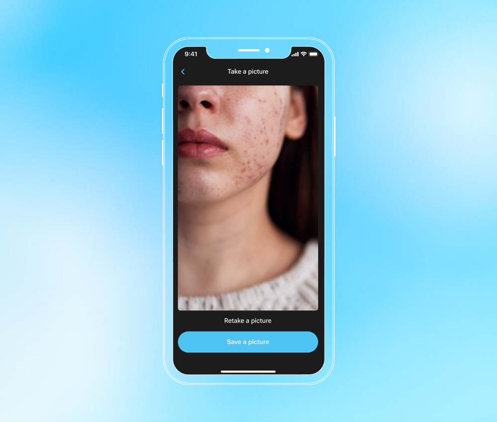 AI-powered skin diagnostic app