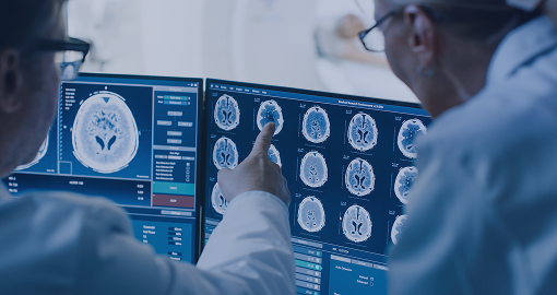 Healthcare professionals reviewing neurological MRI results on a multi-screen setup.